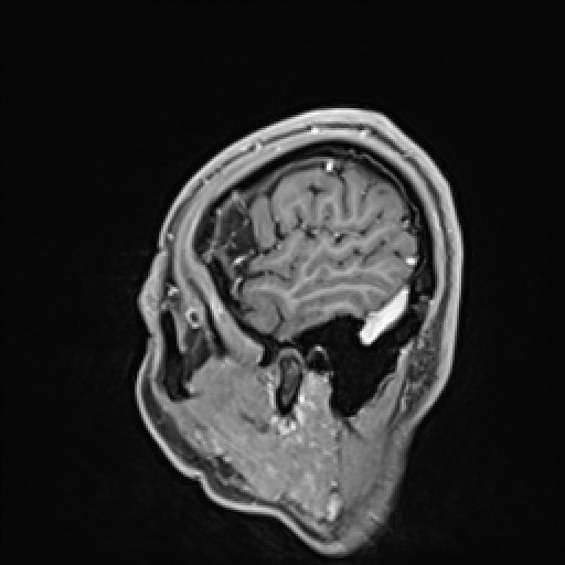 Click on the Serie image to view the images of VILLANUEVA, WILLIAM A.